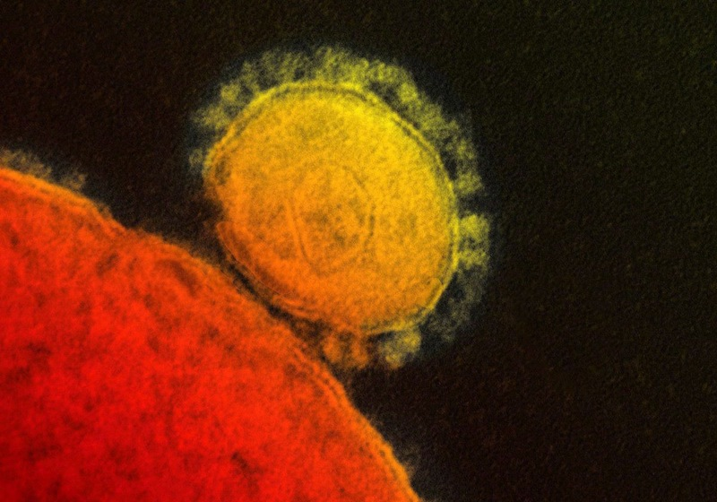Illustration for article titled Psychedelic Images of Terrifying Viruses